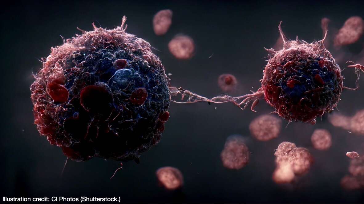 My Journey with Cancer Part 2. Cancer cells dividing.